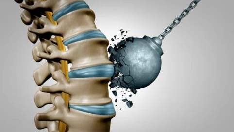 Collagen peptides and bones Collagen peptides and bones